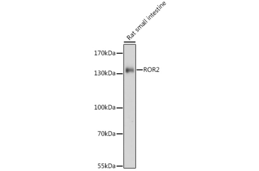 Western Blot - Anti-ROR2 Antibody (A88261) - Antibodies.com
