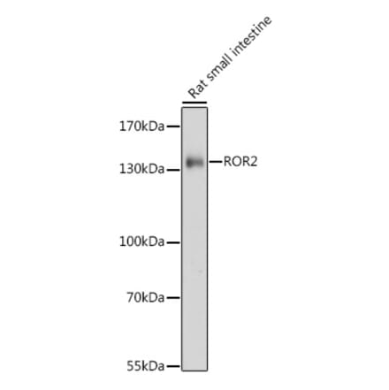 Western Blot - Anti-ROR2 Antibody (A88261) - Antibodies.com