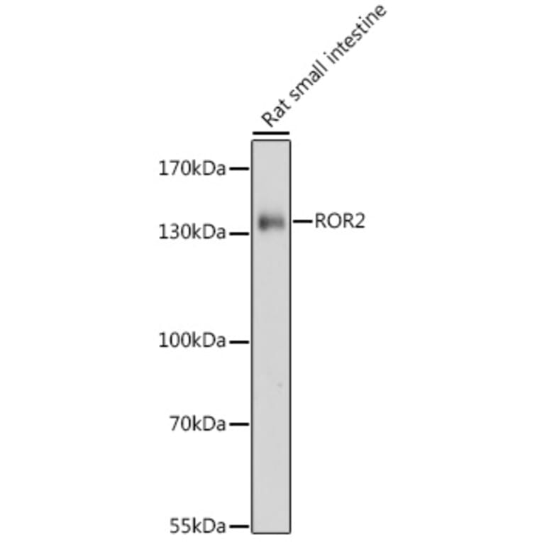 Western Blot - Anti-ROR2 Antibody (A88261) - Antibodies.com
