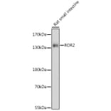 Western Blot - Anti-ROR2 Antibody (A88261) - Antibodies.com