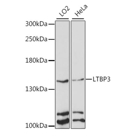 Western Blot - Anti-LTBP3 Antibody (A88262) - Antibodies.com