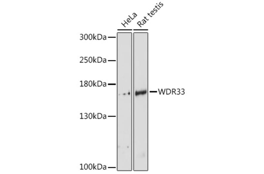 Western Blot - Anti-WDR33 Antibody (A88264) - Antibodies.com