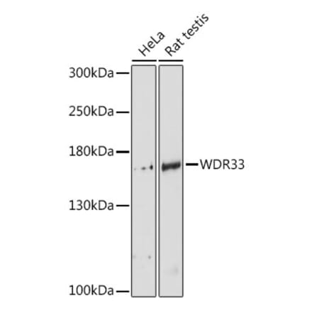 Western Blot - Anti-WDR33 Antibody (A88264) - Antibodies.com