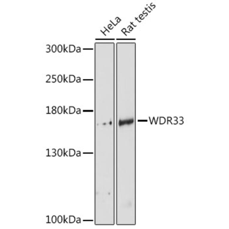 Western Blot - Anti-WDR33 Antibody (A88264) - Antibodies.com