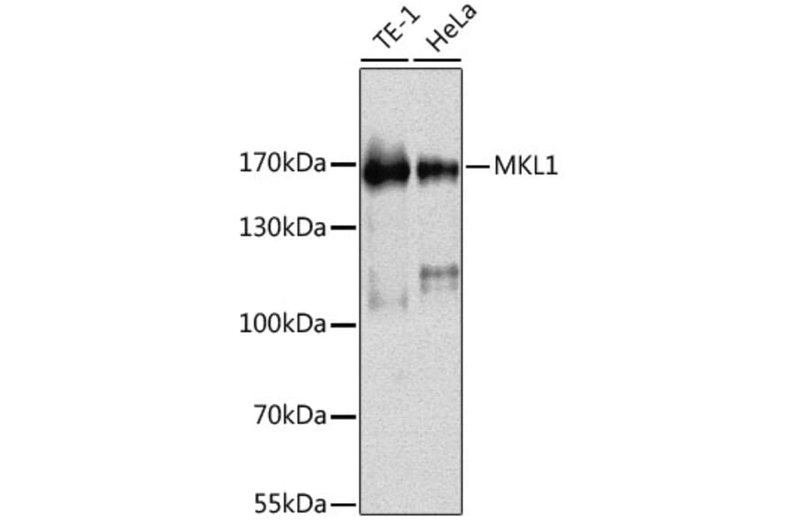 Western Blot - Anti-Mkl1/MRTFA Antibody (A88265) - Antibodies.com