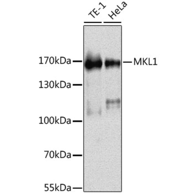 Western Blot - Anti-Mkl1/MRTFA Antibody (A88265) - Antibodies.com