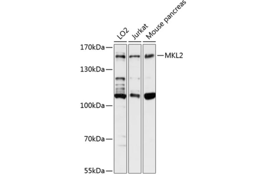 Western Blot - Anti-MKL2 Antibody (A88266) - Antibodies.com