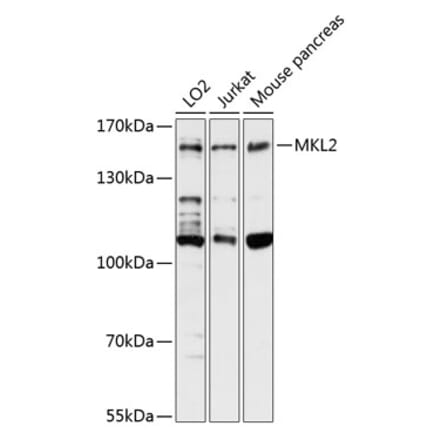 Western Blot - Anti-MKL2 Antibody (A88266) - Antibodies.com