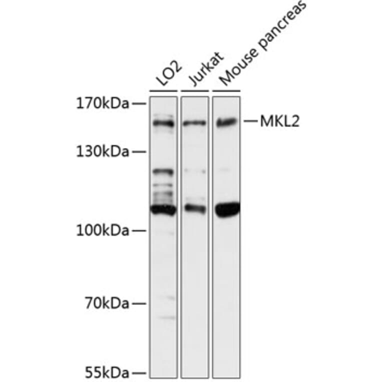 Western Blot - Anti-MKL2 Antibody (A88266) - Antibodies.com
