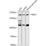 Western Blot - Anti-MKL2 Antibody (A88266) - Antibodies.com
