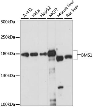 Western blot analysis of extracts of various cell lines, using Anti-BMS1 Antibody (A15367) at 1:1,000 dilution.
Secondary antibody: Goat Anti-Rabbit IgG (H+L) (HRP) (AS014) at 1:10,000 dilution.
Lysates / proteins: 25µg per lane.
Blocking buffer: 3% non-fat dry milk in TBST.
Detection: ECL Enhanced Kit (RM00021).
Exposure time: 15s.