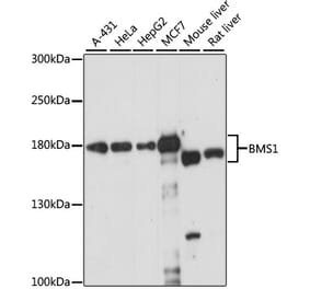 Western Blot - Anti-BMS1 Antibody (A88268) - Antibodies.com