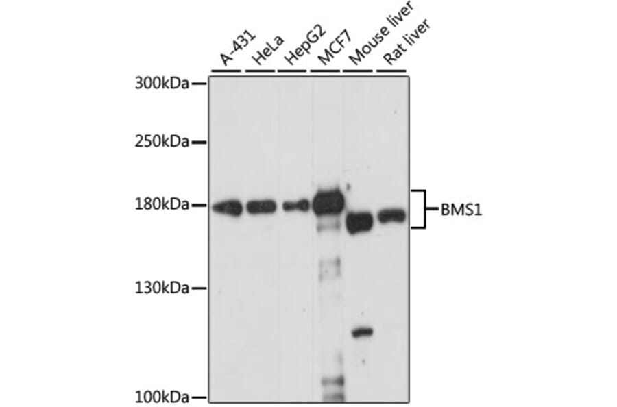 Western Blot - Anti-BMS1 Antibody (A88268) - Antibodies.com
