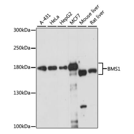 Western Blot - Anti-BMS1 Antibody (A88268) - Antibodies.com