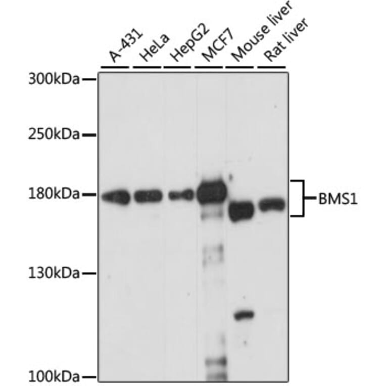 Western Blot - Anti-BMS1 Antibody (A88268) - Antibodies.com