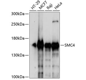 Western Blot - Anti-SMC4 Antibody (A88269) - Antibodies.com