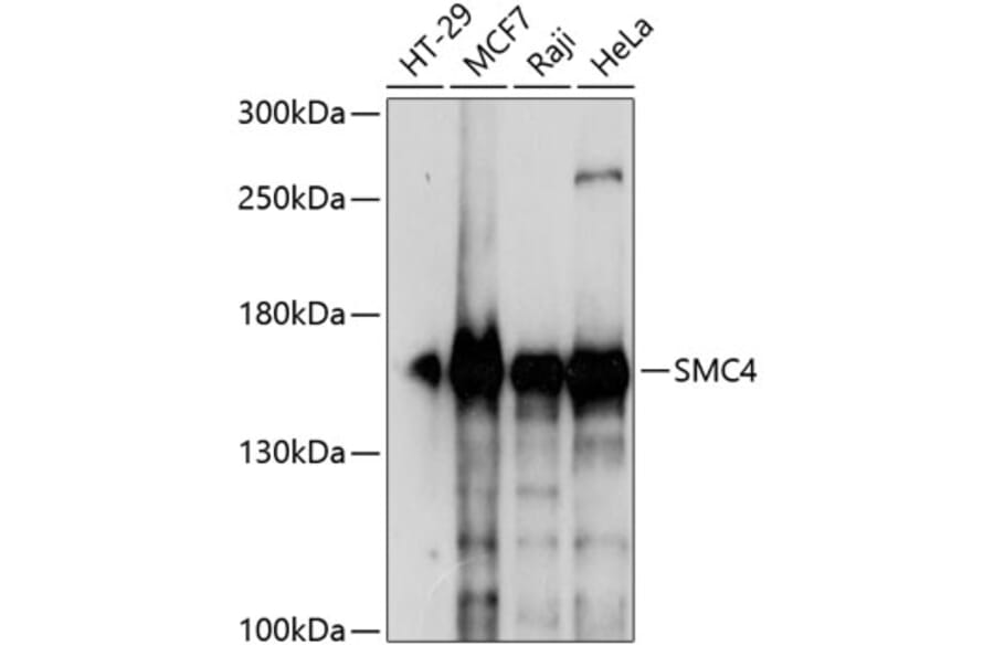 Western Blot - Anti-SMC4 Antibody (A88269) - Antibodies.com