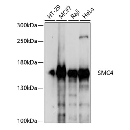 Western Blot - Anti-SMC4 Antibody (A88269) - Antibodies.com