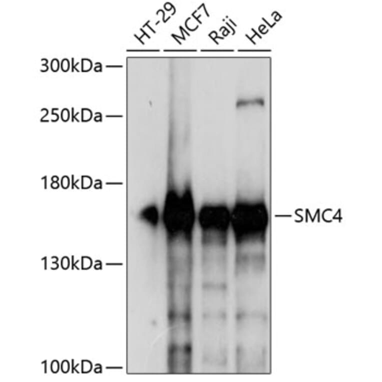 Western Blot - Anti-SMC4 Antibody (A88269) - Antibodies.com