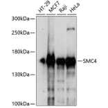 Western Blot - Anti-SMC4 Antibody (A88269) - Antibodies.com