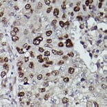 Immunohistochemistry - Anti-KDM3A/JHDM2A Antibody (A88270) - Antibodies.com