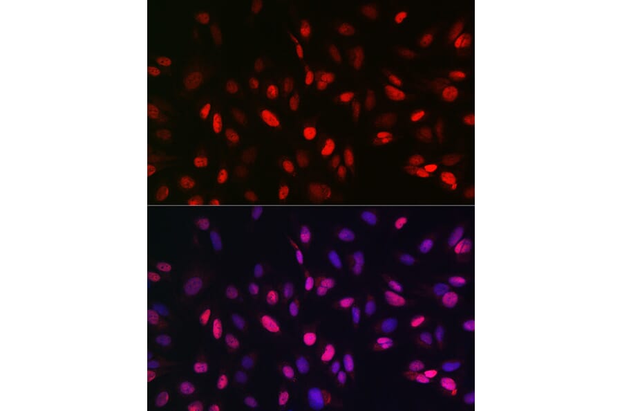 Immunofluorescence - Anti-KDM3A/JHDM2A Antibody (A88270) - Antibodies.com