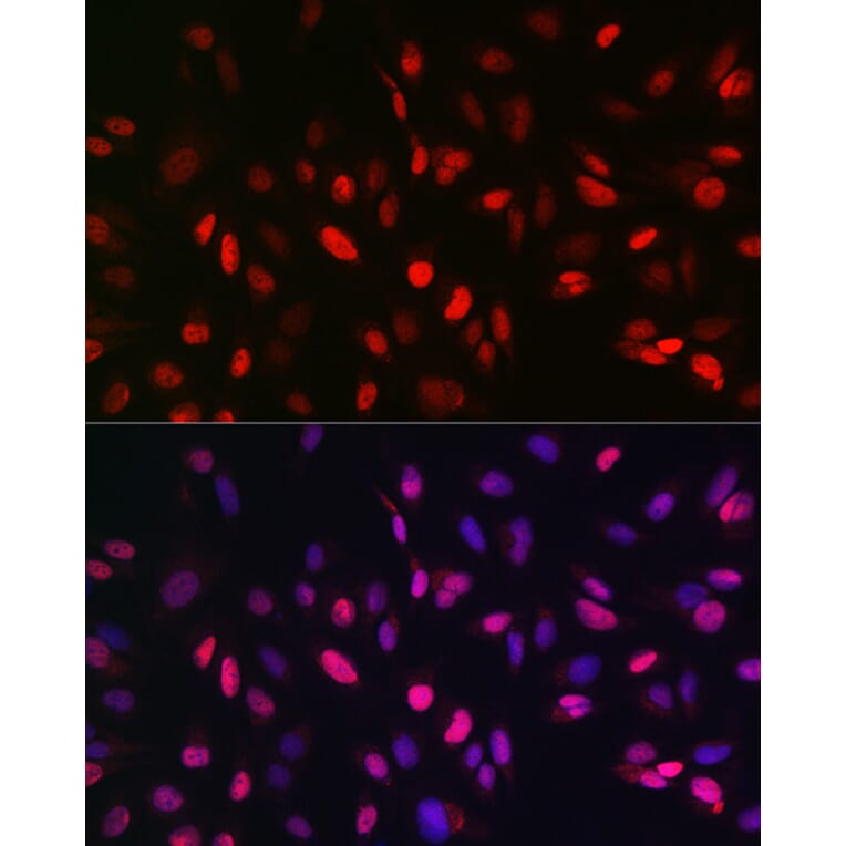 Immunofluorescence - Anti-KDM3A/JHDM2A Antibody (A88270) - Antibodies.com