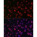 Immunofluorescence - Anti-KDM3A/JHDM2A Antibody (A88270) - Antibodies.com