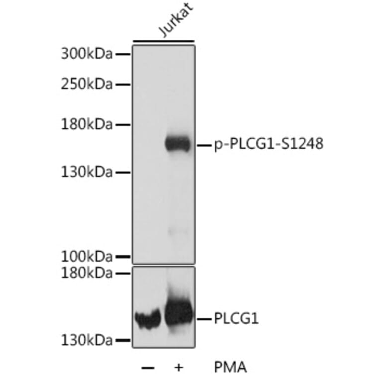 Western Blot - Anti-Phospholipase C gamma 1/PLC-gamma-1 (phospho Ser1248) Antibody (A88272) - Antibodies.com