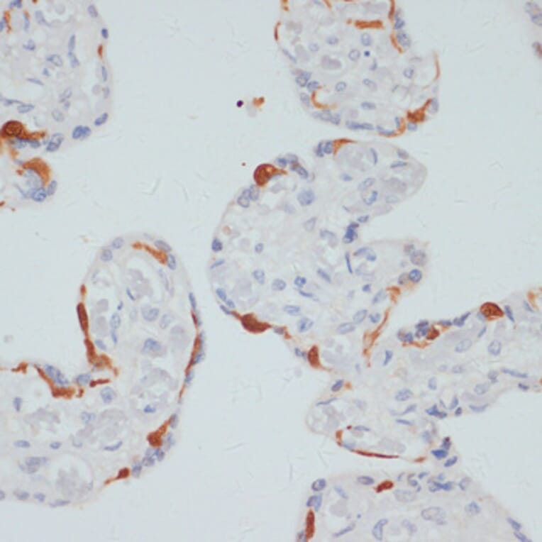 Immunohistochemistry - Anti-Phospholipase C gamma 1/PLC-gamma-1 (phospho Ser1248) Antibody (A88272) - Antibodies.com