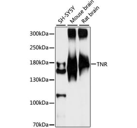 Western Blot - Anti-TNR Antibody (A88273) - Antibodies.com