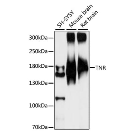 Western Blot - Anti-TNR Antibody (A88273) - Antibodies.com