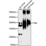 Western Blot - Anti-TNR Antibody (A88273) - Antibodies.com