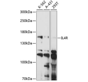 Western Blot - Anti-IL-4R Antibody (A88274) - Antibodies.com