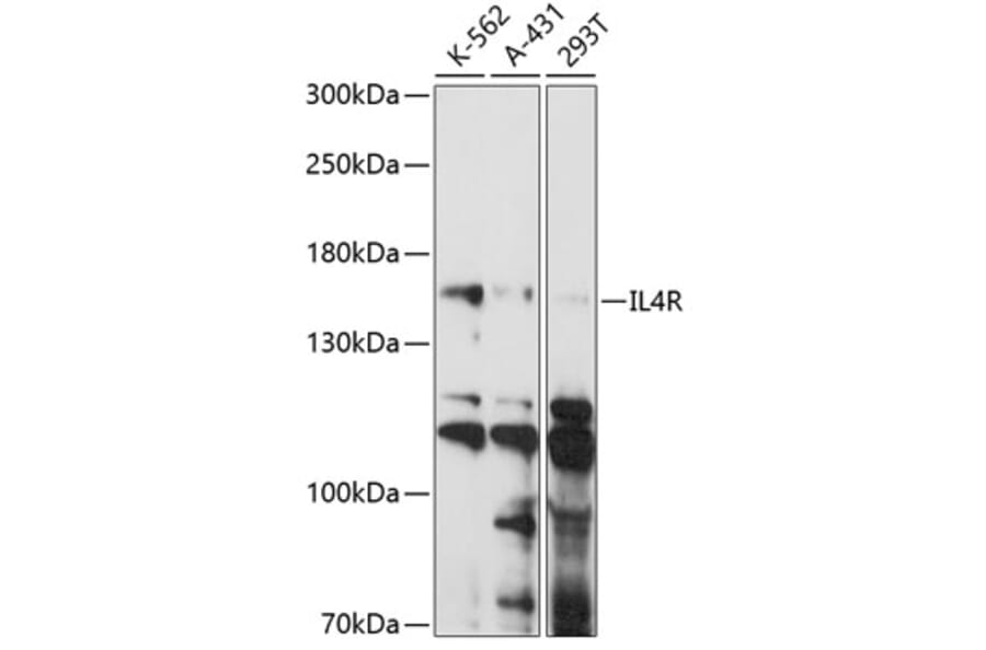 Western Blot - Anti-IL-4R Antibody (A88274) - Antibodies.com