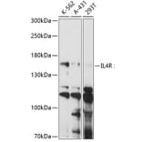 Western Blot - Anti-IL-4R Antibody (A88274) - Antibodies.com