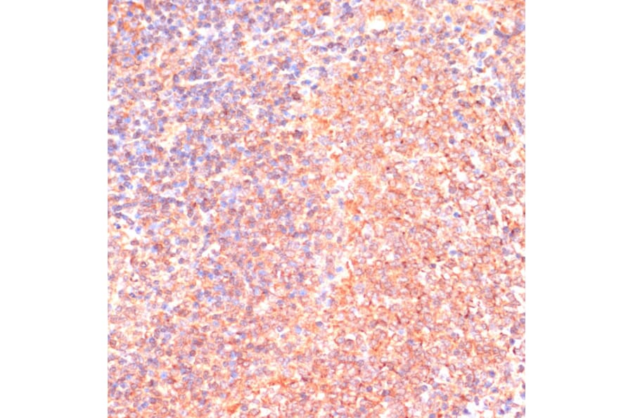 Immunohistochemistry - Anti-IL-4R Antibody (A88274) - Antibodies.com