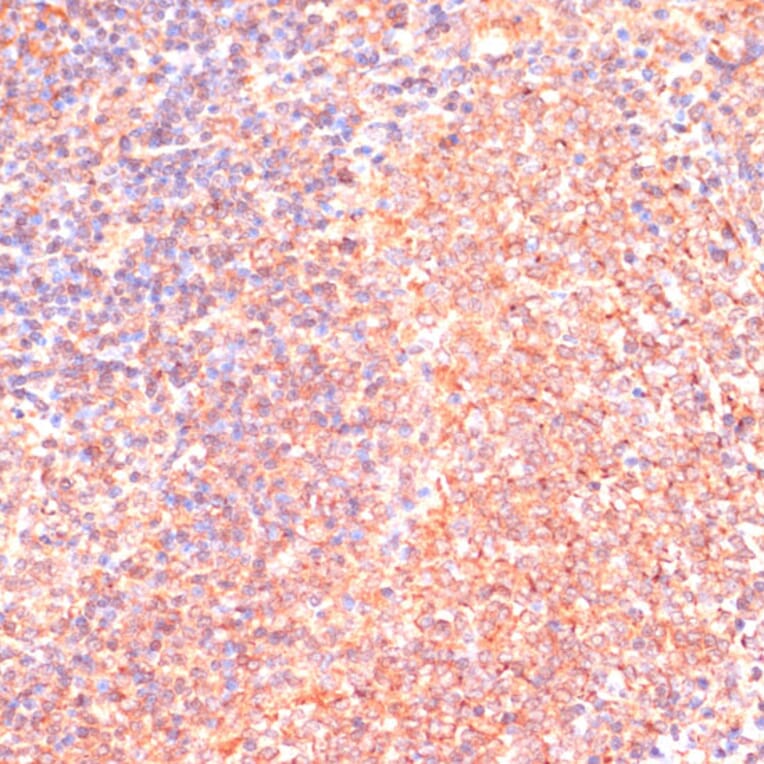 Immunohistochemistry - Anti-IL-4R Antibody (A88274) - Antibodies.com