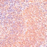 Immunohistochemistry - Anti-IL-4R Antibody (A88274) - Antibodies.com