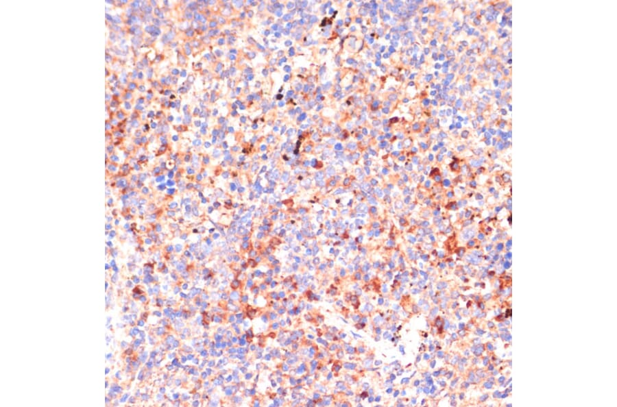 Immunohistochemistry - Anti-IL-4R Antibody (A88274) - Antibodies.com