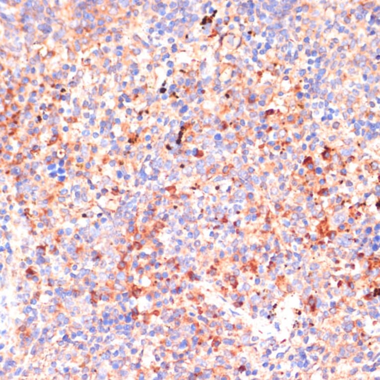 Immunohistochemistry - Anti-IL-4R Antibody (A88274) - Antibodies.com