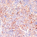 Immunohistochemistry - Anti-IL-4R Antibody (A88274) - Antibodies.com