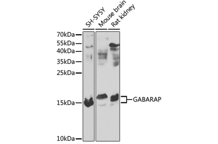 Western Blot - Anti-GABARAP Antibody (A88276) - Antibodies.com