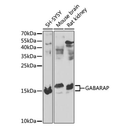 Western Blot - Anti-GABARAP Antibody (A88276) - Antibodies.com