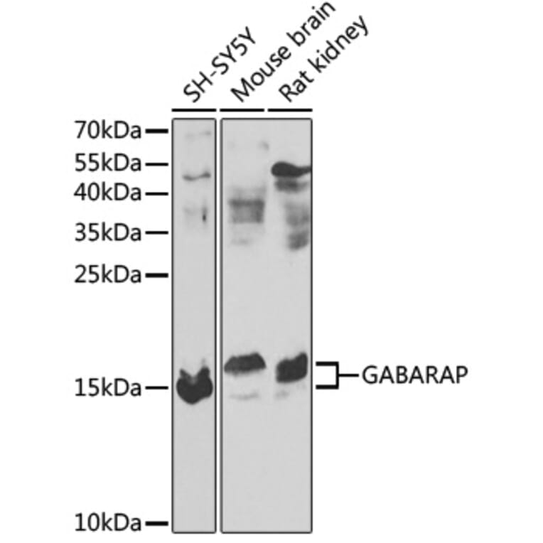 Western Blot - Anti-GABARAP Antibody (A88276) - Antibodies.com