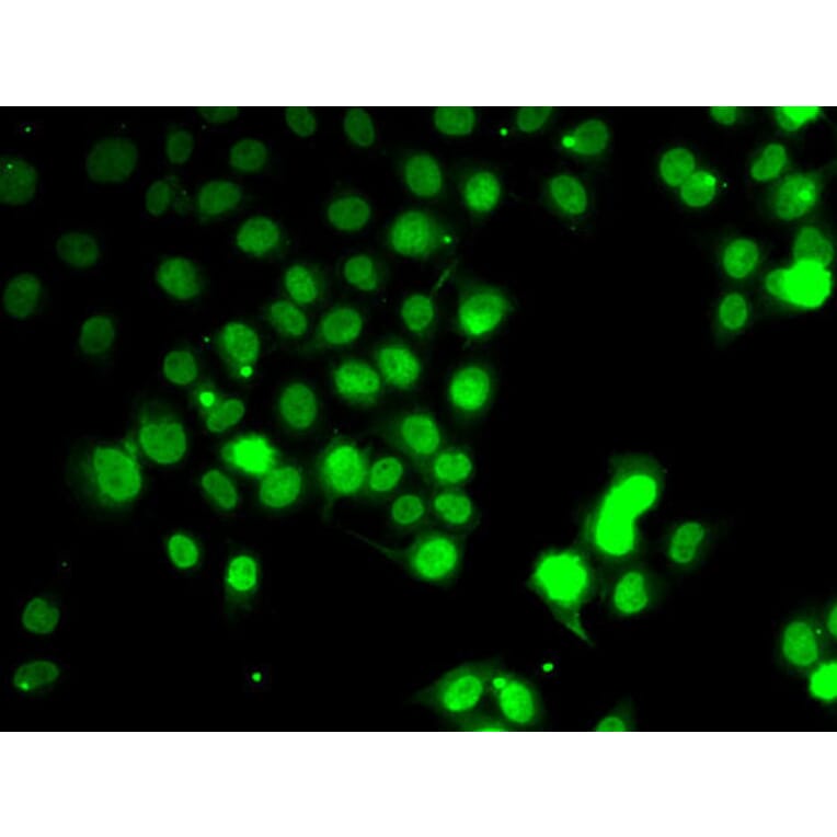 Immunofluorescence - Anti-GABARAP Antibody (A88276) - Antibodies.com