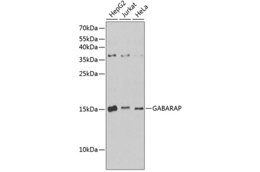 Western Blot - Anti-GABARAP Antibody (A88277) - Antibodies.com