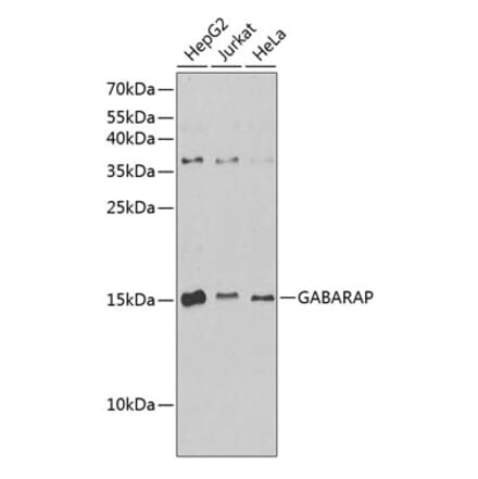 Western Blot - Anti-GABARAP Antibody (A88277) - Antibodies.com