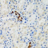 Immunohistochemistry - Anti-GABARAP Antibody (A88277) - Antibodies.com