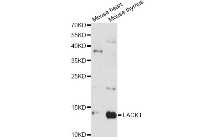 Western Blot - Anti-LACRT Antibody (A14632) - Antibodies.com